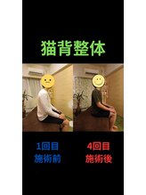 姿勢リカバリー 新宿店/猫背整体