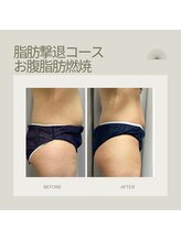 FJ/薄着の季節に向けて◇徹底燃焼！