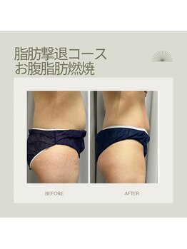 FJ/薄着の季節に向けて◇徹底燃焼!