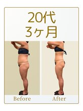 キュール(KuhL)/20代痩身ビフォーアフター☆