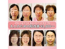 キュララ(KYURARA)