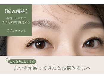 エトワール(Etoile)/まつ毛が減ってきたと感じる方へ