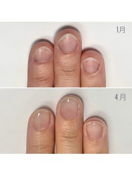 リモネイル(Rimo nail)/