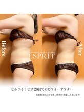 エスプリ 銀座店/痩身エステ銀座・ブライダル