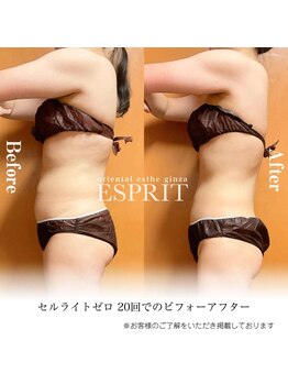 エスプリ 銀座店/痩身エステ銀座・ブライダル