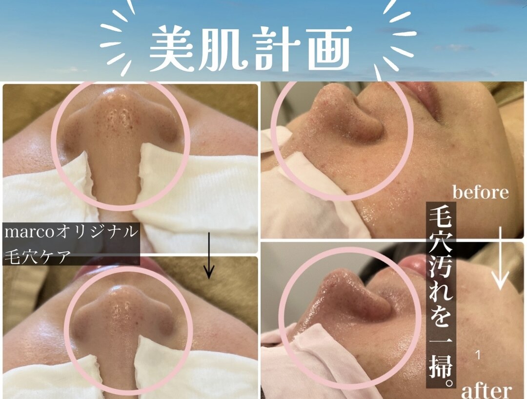 マルコ(marco)｜ホットペッパービューティー