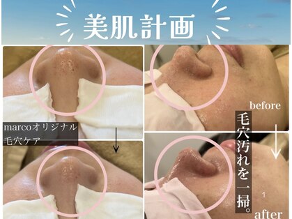 マルコ(marco)の写真