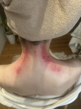 リュクス(Luxe)/夜中目が覚めなくなった！