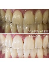 ホワイトニングルーム 川崎店(WhiteningRoom)/ホワイトニング/川崎