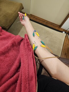 はりきゅう和 ルート鍼灸院/鍼パルスの例