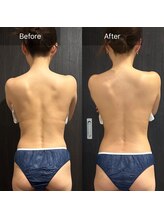 ルネアススパ 南青山(Lune’as Spa)/《WINBACK》背中