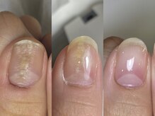 フェミニンネイル(Feminine Nail)の雰囲気(自爪育成資格所有。見た目が変わる!爪のコンプレックス解消。)