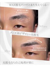リノア(Linoa)/メンズ眉毛ビフォーアフター