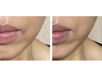 サロン リーナ 北千住店(Salon Lena)/こだわりの自社製品VinatuleVC30