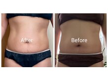 ミルグレイン(MILGRAIN)/全3回来店