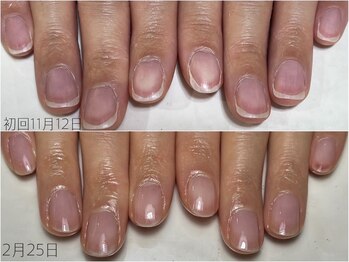 自爪育成３ヵ月コース