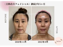ロードローズ(l'eau D rose)の雰囲気（最短3ヶ月でコンシーラーいらずのナチュラル健康美肌へ♪）