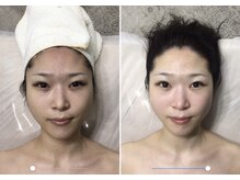 自然美人/小顔コルギの効果