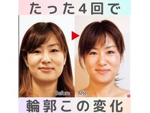 ロコモ 美容矯正サロン(Locomo)