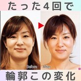 ロコモ 美容矯正サロン(Locomo)
