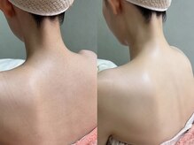 ソルシエール キレイ(ソルシエールkirei)/うなじ×背中(ハーフ)