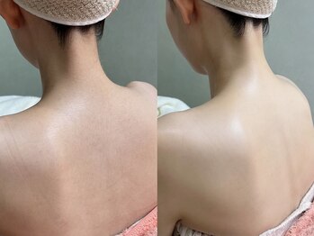 ソルシエール キレイ(ソルシエールkirei)/うなじ×背中(ハーフ)