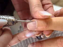 Step1【マシーンで角質を除去】