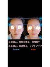 美容矯正サロン レレポノ(LELEPONO)/