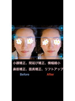 美容矯正サロン レレポノ(LELEPONO)/