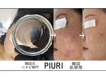 ピウリ(PIURI)