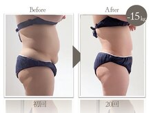 ビューティーリバース センター北店/★劇的ビフォーアフター★