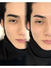 プール 鹿児島中央駅店(POOL)/wax脱毛