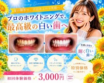 LBSホワイトニング 上野店