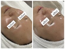フェリス(FELIZ)の雰囲気(水を一切不使用の非変性生プラセンタで日を追う毎にもちもち肌へ)