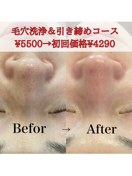 マーヤ(Ma-ya)/初回4290円毛穴洗浄&引き締め