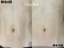 エリーザベル(Elisa Bell)/メンズ脱毛
