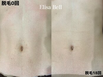エリーザベル(Elisa Bell)/メンズ脱毛