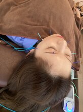 ハリファ鍼灸院 横浜関内院(HariFa鍼灸院)/美容鍼施術/美容鍼