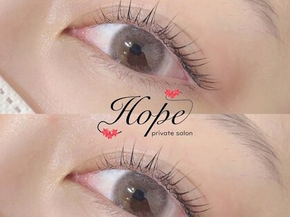 ホープ(Hope)の写真