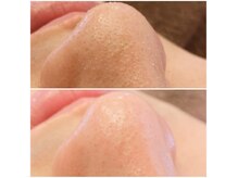 スキンケアサロン ベル(Bell)の雰囲気（毛穴洗浄コースのお客様からはツルツル～凄い！というお声が♪）