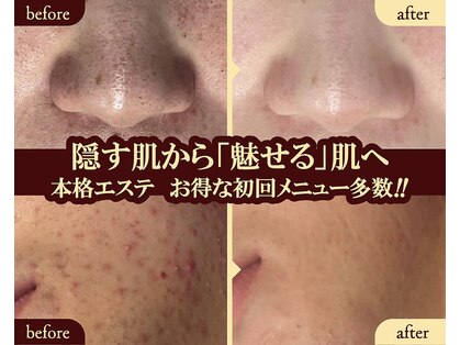 サバーイ サバーイ(SABAHI SABAHI)の写真