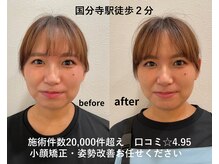リファイン整体院 国分寺店
