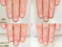 ナユネイル(na_yu.nail)/地爪育成｜お悩み改善