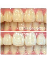ホワイトニングルーム 横浜店(Whitening Room)/セルフホワイトニング/横浜