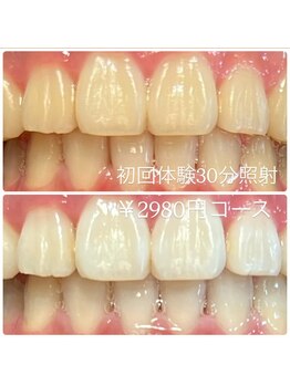 ホワイトニングルーム 横浜店(Whitening Room)/セルフホワイトニング/横浜