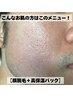 【毛穴の開きや乾燥を改善したい!】ヒゲ脱毛(顔)+高保湿パック ¥5,000