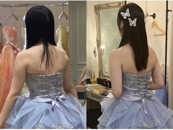 ルアナアイナ 大分の写真/【挙式やフォトを最高の姿で】お悩みに合わせた施術&丁寧なカウンセリングで、ドレスの映える美肌に◎