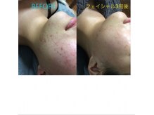 サロン モイ(salon moi)/