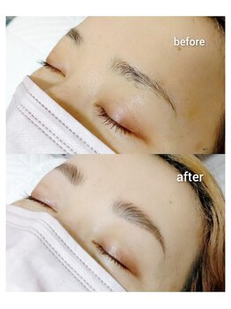 マツ(MATSU)/【ハリウッドブロウリフト】