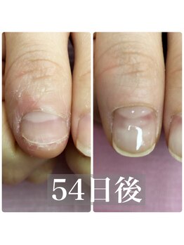 イリスネイル(IRIS NAIL)/